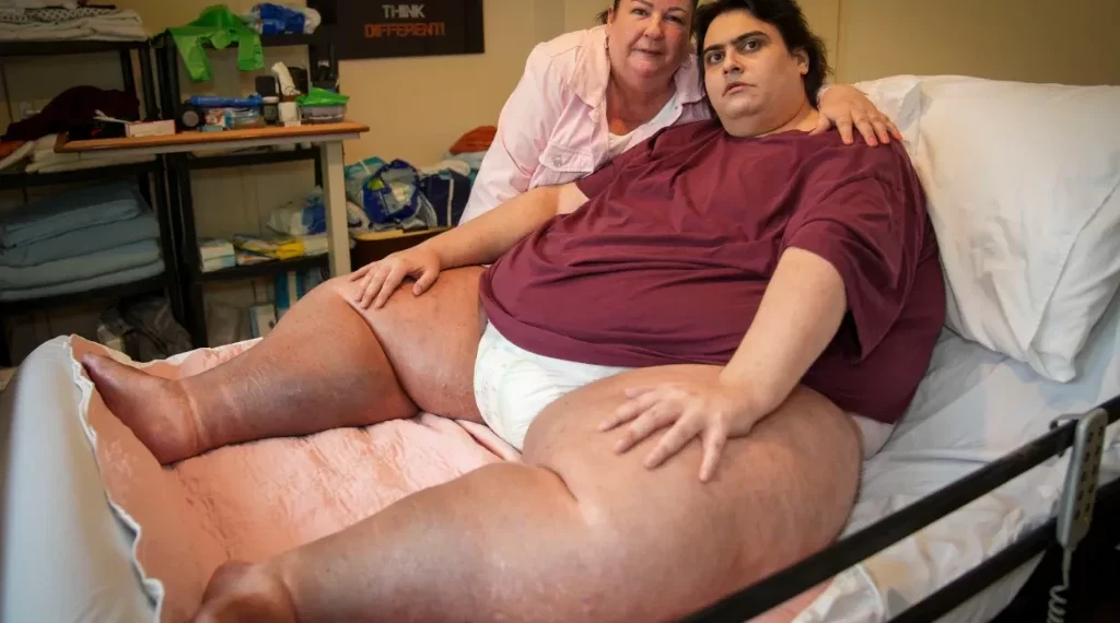 Jason Holton, Britain's Heaviest Man, Dies Of Organ Failure At 33