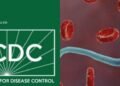 NCDC_Ebola_Virus_Disease_Copy_1 - Newscoven No Cases Of Ebola Virus In Nigeria -NCDC •Issues Health, Travel Advisory